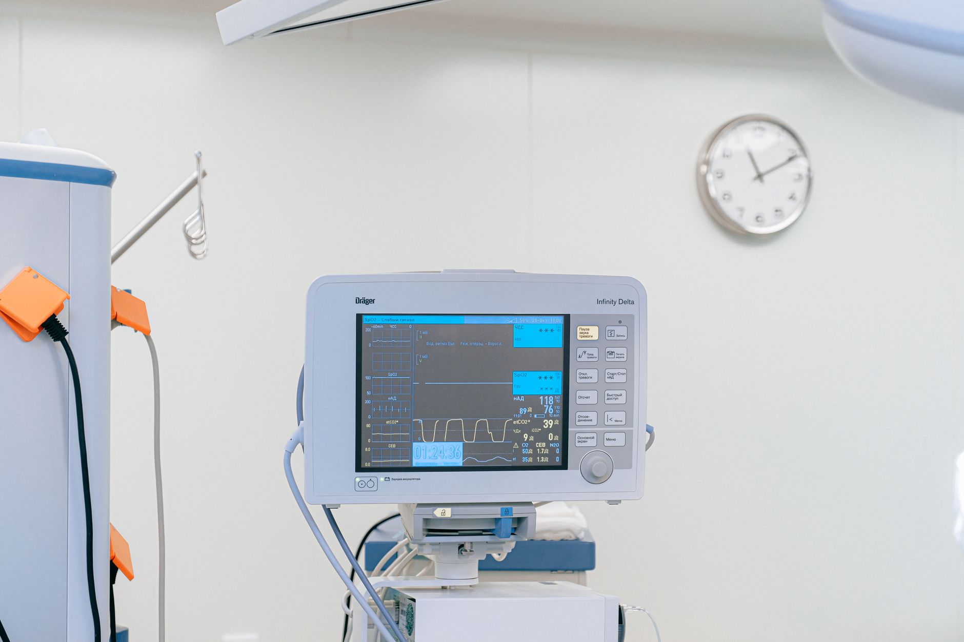 rows of ICU monitoring workstations with screens displaying patient vital-sign waveforms in a modern hospital control room, no people as focal point
