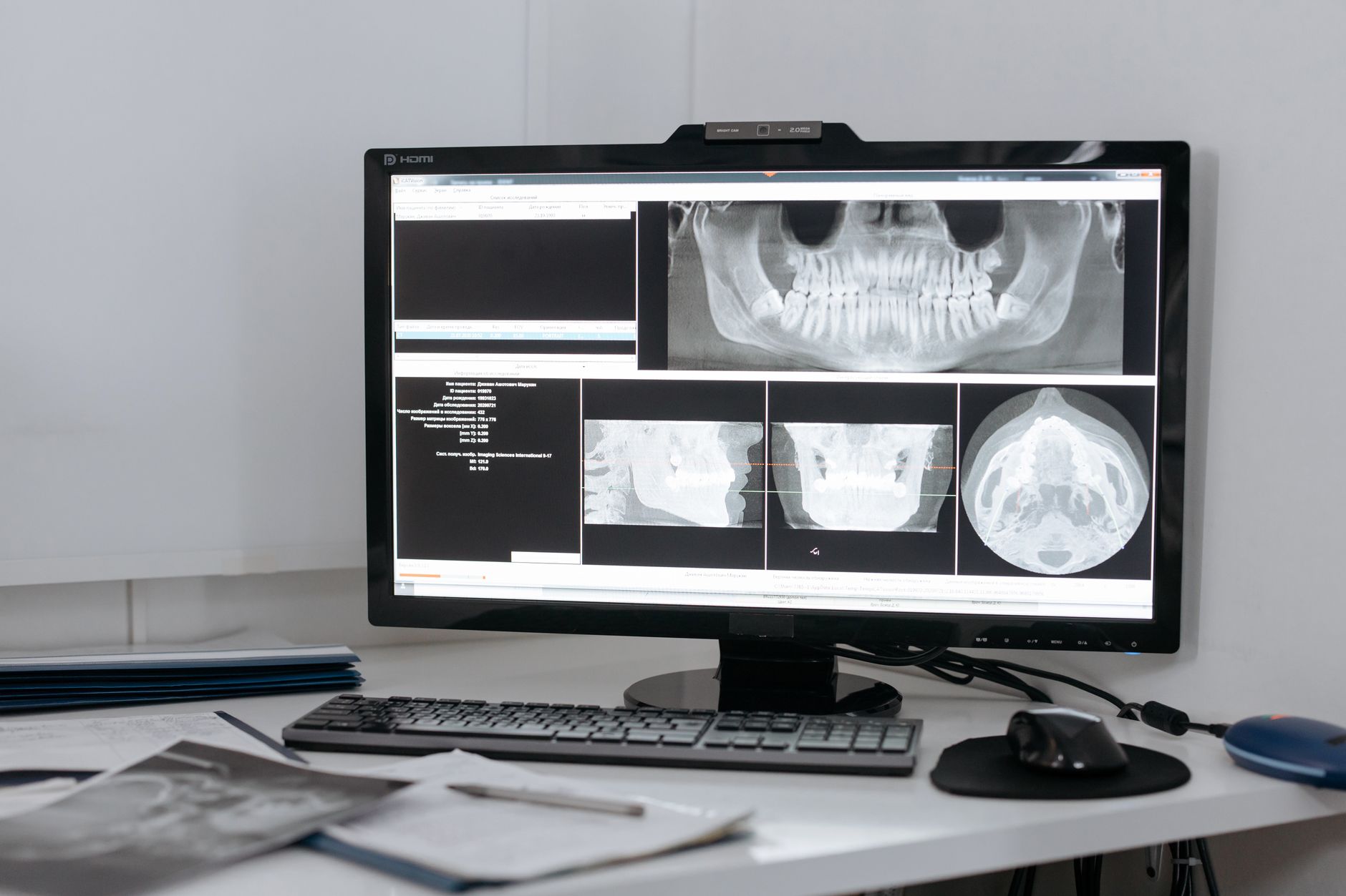 a cardiac catheterization laboratory with imaging equipment and a procedure table surrounded by monitors displaying vascular imagery, no personnel visible as focal point